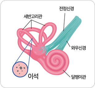 명주병원 특성화센터 > 어지럼증센터 > 치료법